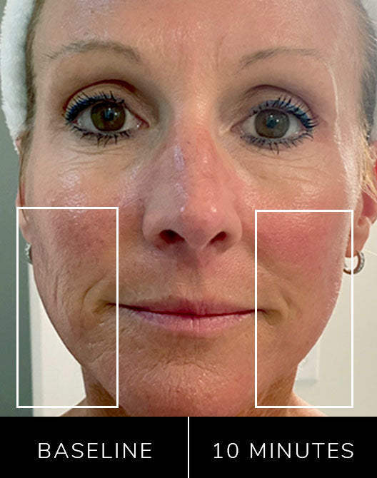 Eno Patented All-In-One Skincare Device