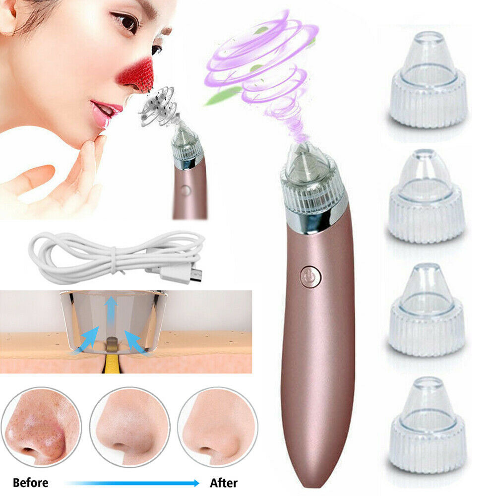 Electric Blackhead Vacuum Pore Cleaner - Acne Pimple Remover