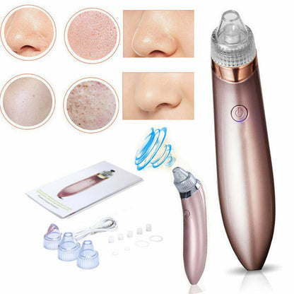 Electric Blackhead Vacuum Pore Cleaner - Acne Pimple Remover