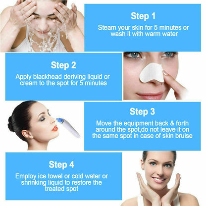 Electric Blackhead Vacuum Pore Cleaner - Acne Pimple Remover