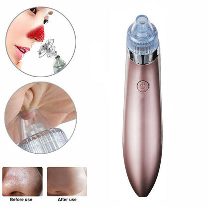 Electric Blackhead Vacuum Pore Cleaner - Acne Pimple Remover