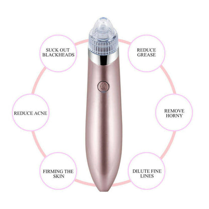Electric Blackhead Vacuum Pore Cleaner - Acne Pimple Remover