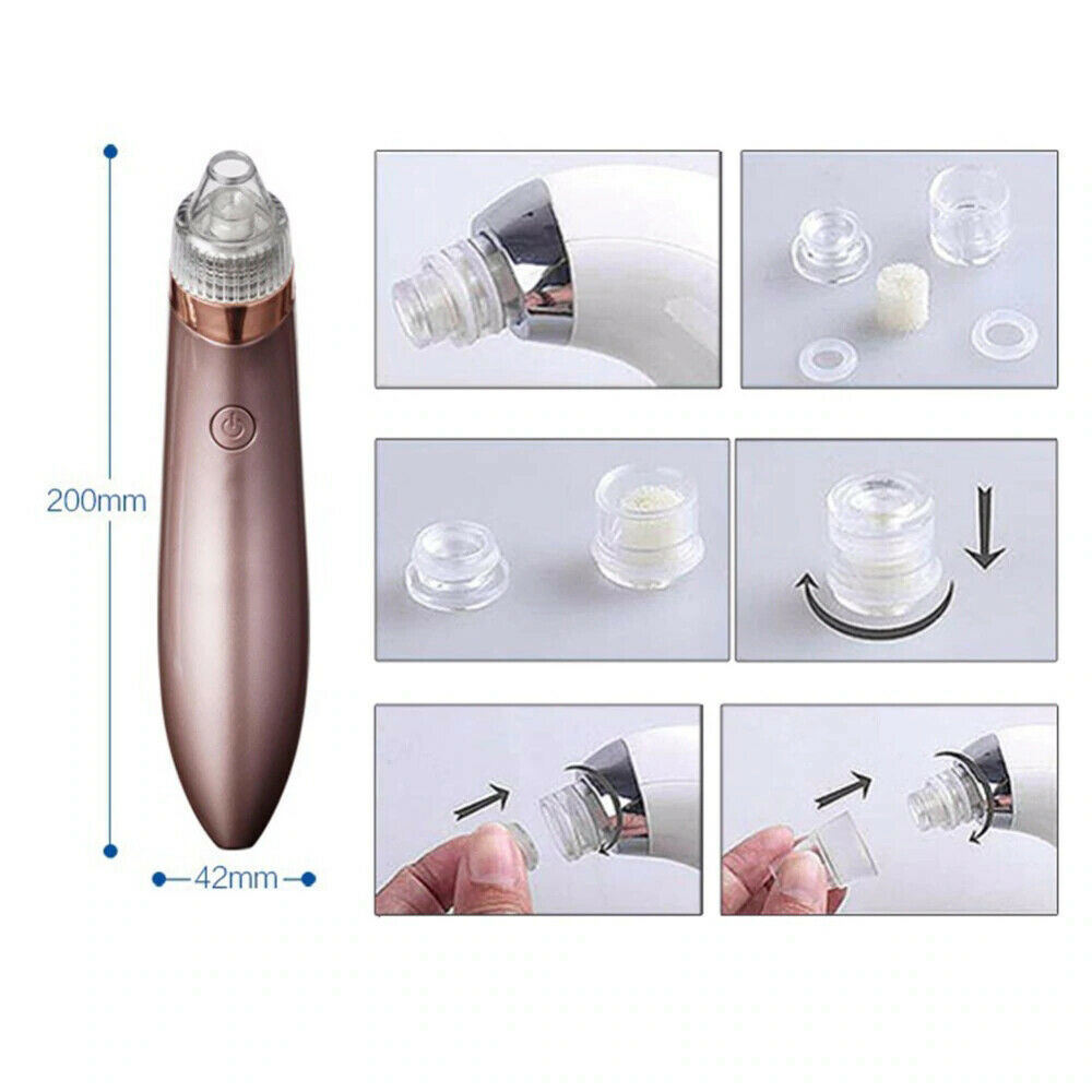 Electric Blackhead Vacuum Pore Cleaner - Acne Pimple Remover