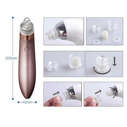Electric Blackhead Vacuum Pore Cleaner - Acne Pimple Remover